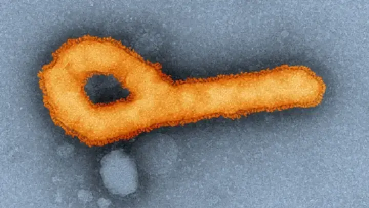 Ebola Fieber - Mikroskop-Aufnahme des Virus
